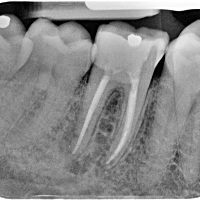 721106-07-5220-X-20150521-145313-XCSP0ZO8VCHE-3