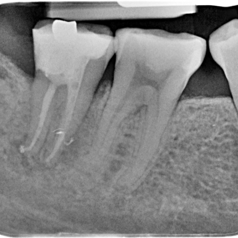 791109-08-6324-X-20150105-121133-XZO6DLEOC8EE-4