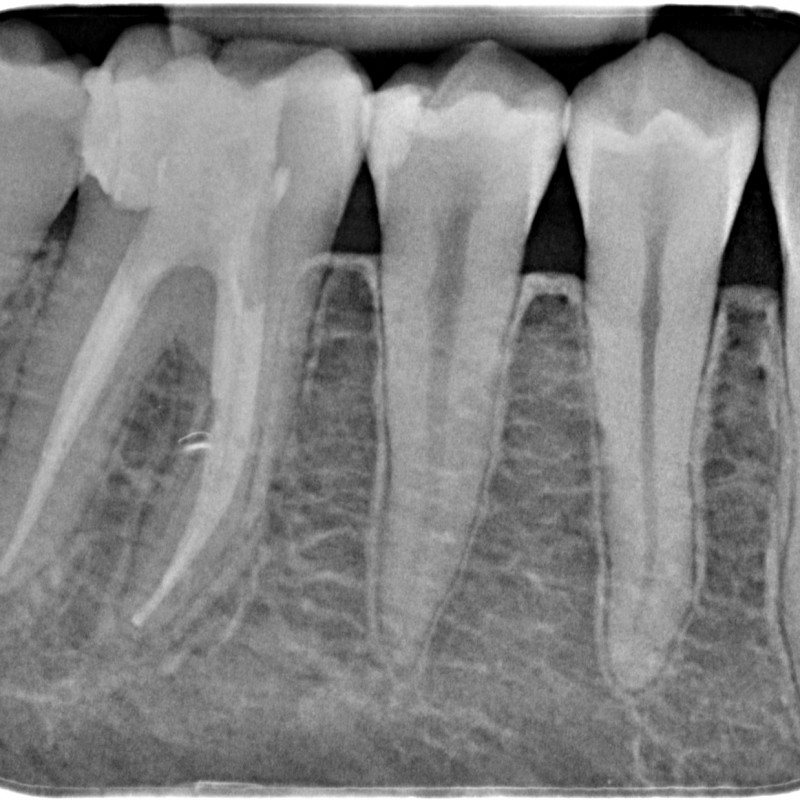 D13106162-X-20141118-170255-XTWABKFAI99T-4